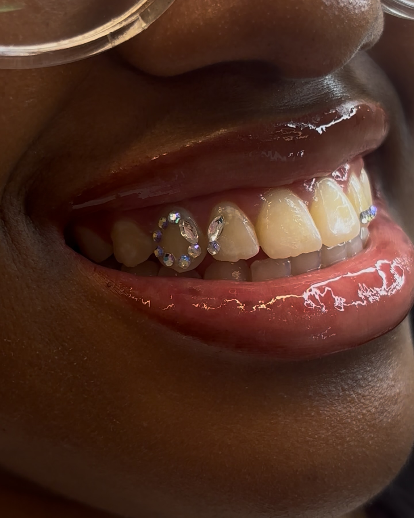 Close-up van tandkristallen op een glimlach
